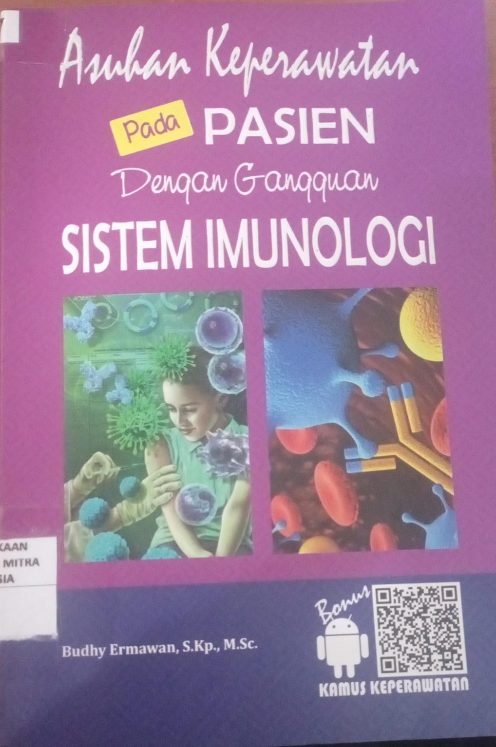 Asuhan Keperawatan Pada Pasien Dengan Gangguan Sistem Imunologi